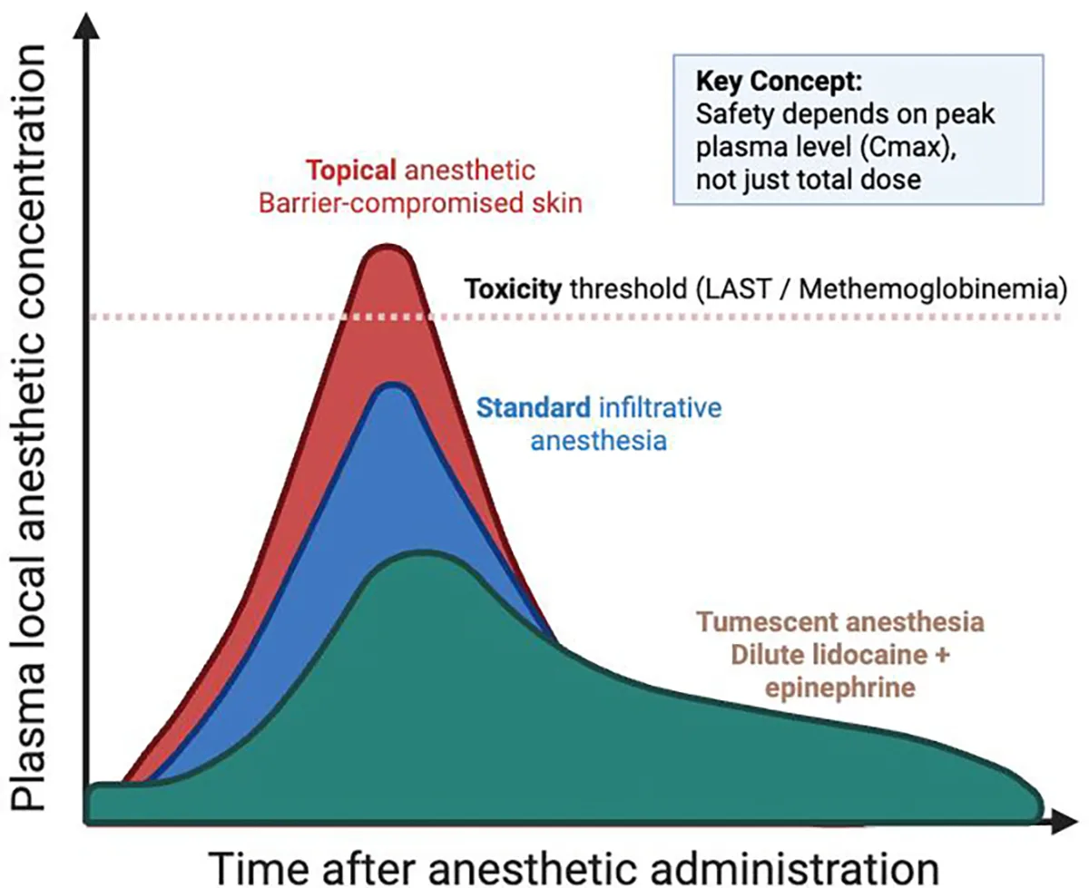 Gráfico conceitual da concentração plasmática de anestésico local no tempo para tópico em pele lesada, infiltração e tumescência — Dr. Thiago Perfeito