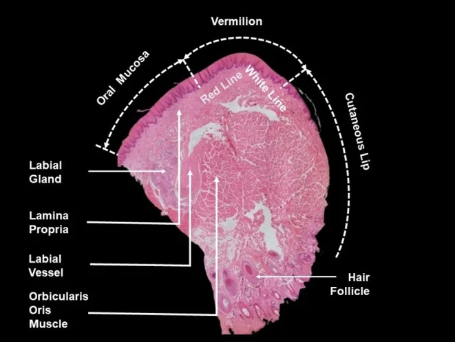 Corte histológico sagital do lábio com orbicular, vaso labial, glândulas e vermelhão — figura de estudo — Dr. Thiago Perfeito