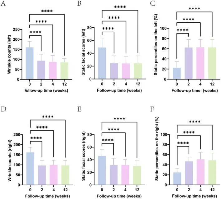 Gráficos de contagem de rugas e escores faciais antes e depois de toxina na pálpebra inferior — Dr. Thiago Perfeito