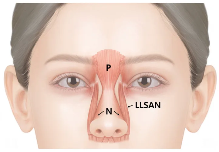 Esquema do prócero, músculo nasal e levantador do lábio superior e da asa do nariz — Dr. Thiago Perfeito