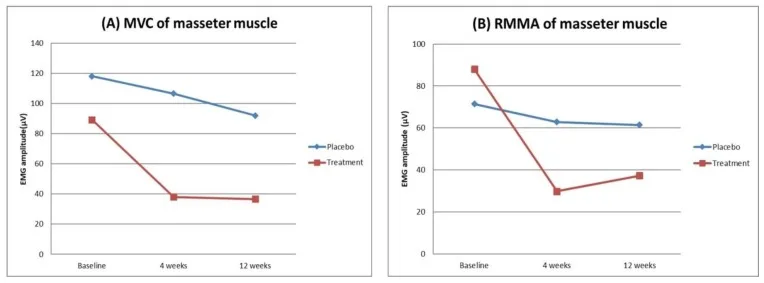 Gráficos de amplitude da eletromiografia do masseter em bruxismo do sono após toxina e placebo — Dr. Thiago Perfeito