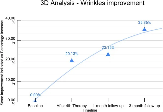 Gráfico da melhora de rugas por análise tridimensional ao longo do tratamento com EMFACE — Dr. Thiago Perfeito