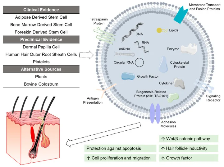 Esquema das fontes de exossomo para alopecia androgenética e da carga da vesícula agindo no folículo — Dr. Thiago Perfeito