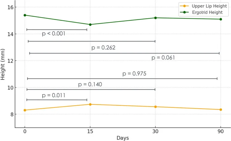 Gráfico da altura do lábio superior e da distância nariz-lábio em 0, 15, 30 e 90 dias após lip flip — figura de estudo — Dr. Thiago Perfeito