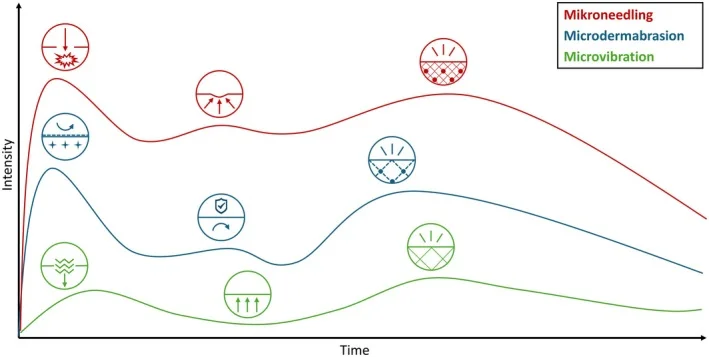 Gráfico da intensidade da reação da pele ao longo do tempo depois de microagulhamento, microdermoabrasão e microvibração — Dr. Thiago Perfeito