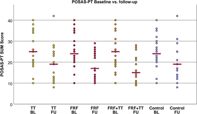 Gráfico de escores POSAS de estrias albas antes e depois de radiofrequência fracionada e tretinoína — Dr. Thiago Perfeito