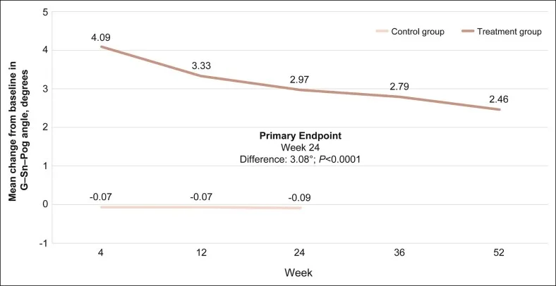 Gráfico da mudança do ângulo glabela-subnasal-pogônio após preenchimento de mento — figura de estudo — Dr. Thiago Perfeito