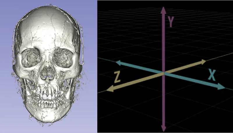 Reconstrução tomográfica do crânio e os três eixos de rotação facial — Dr. Thiago Perfeito