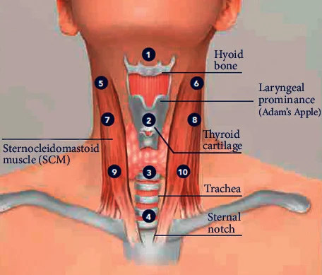 Esquema dos pontos de injeção do bioremodelador no pescoço em três linhas verticais — Dr. Thiago Perfeito