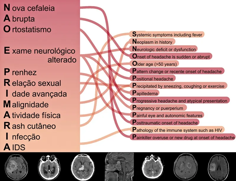 Mnemônico NÃO É PRIMÁRIA ligado aos sinais de alerta da lista SNNOOP10 para cefaleia secundária — Dr. Thiago Perfeito