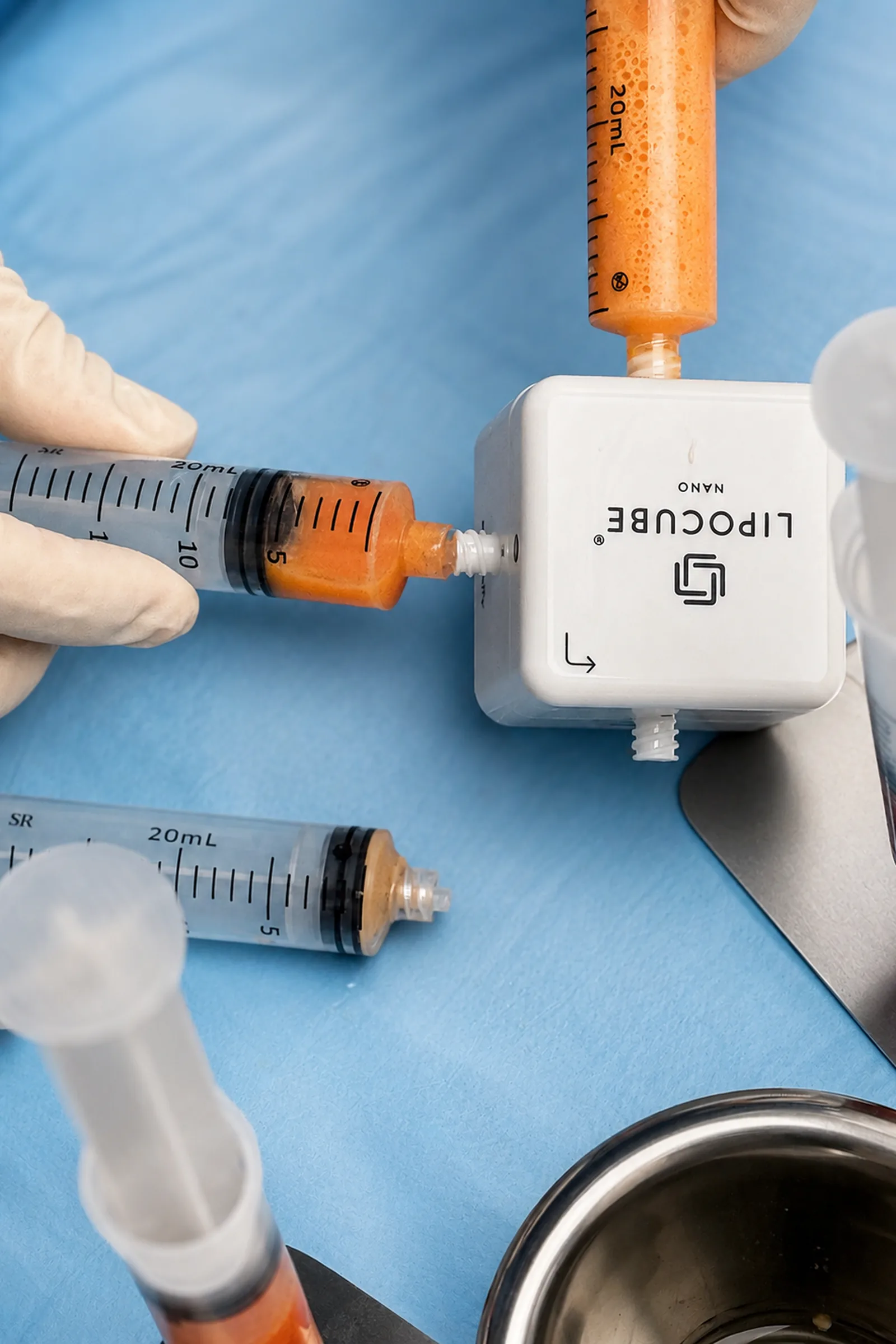 Dr. Thiago Perfeito com o sistema Lipocube para enxertia de gordura em Brasília