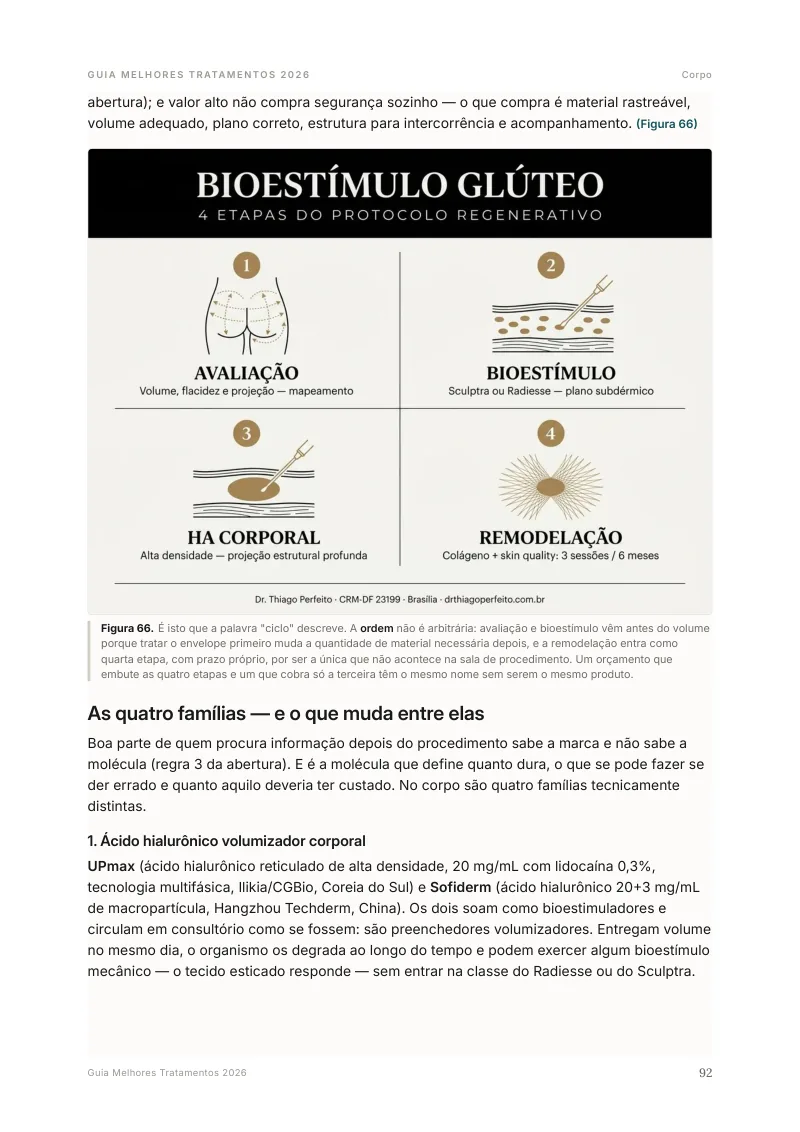 Ilustração do bioestímulo de glúteo em 4 etapas no Guia Melhores Tratamentos 2026