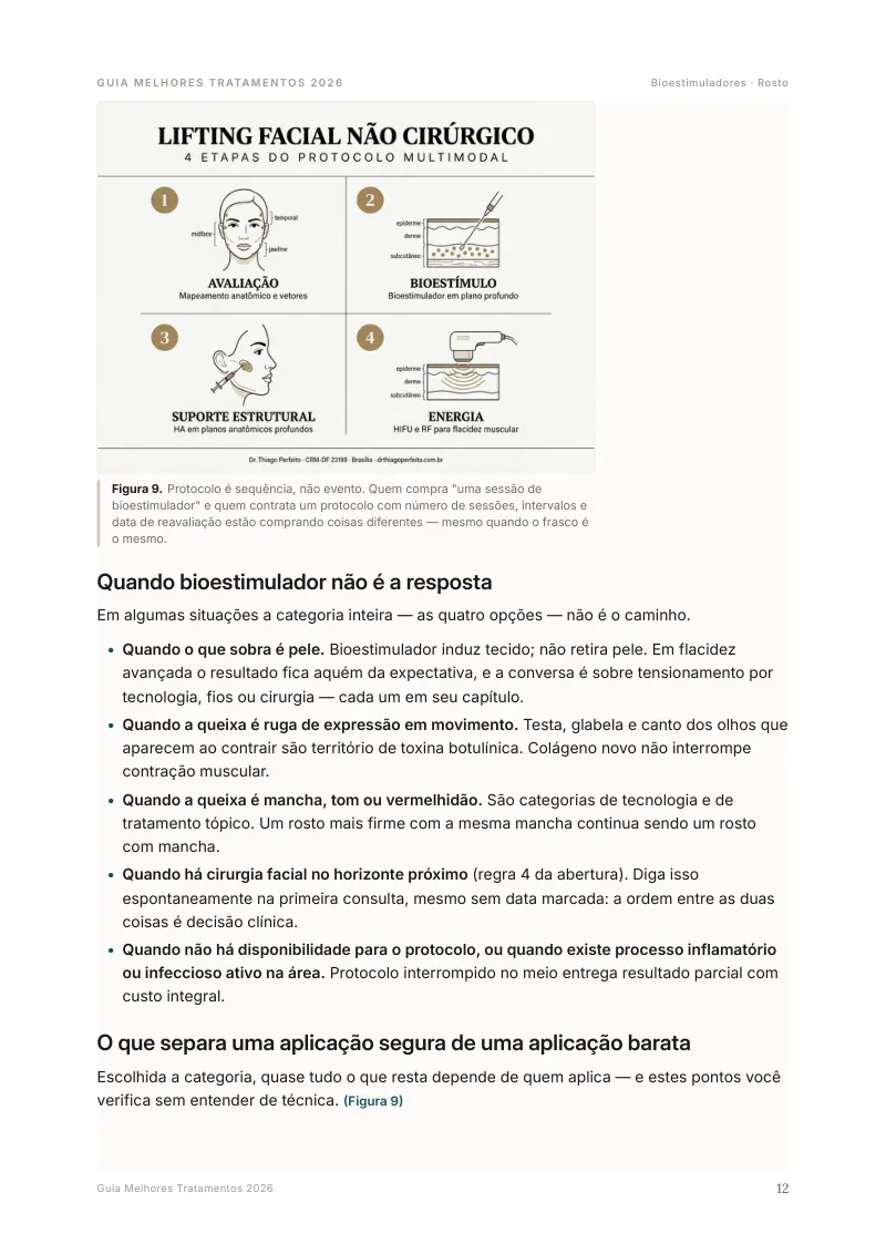 Ilustração do lifting facial não cirúrgico em 4 etapas no Guia Melhores Tratamentos 2026