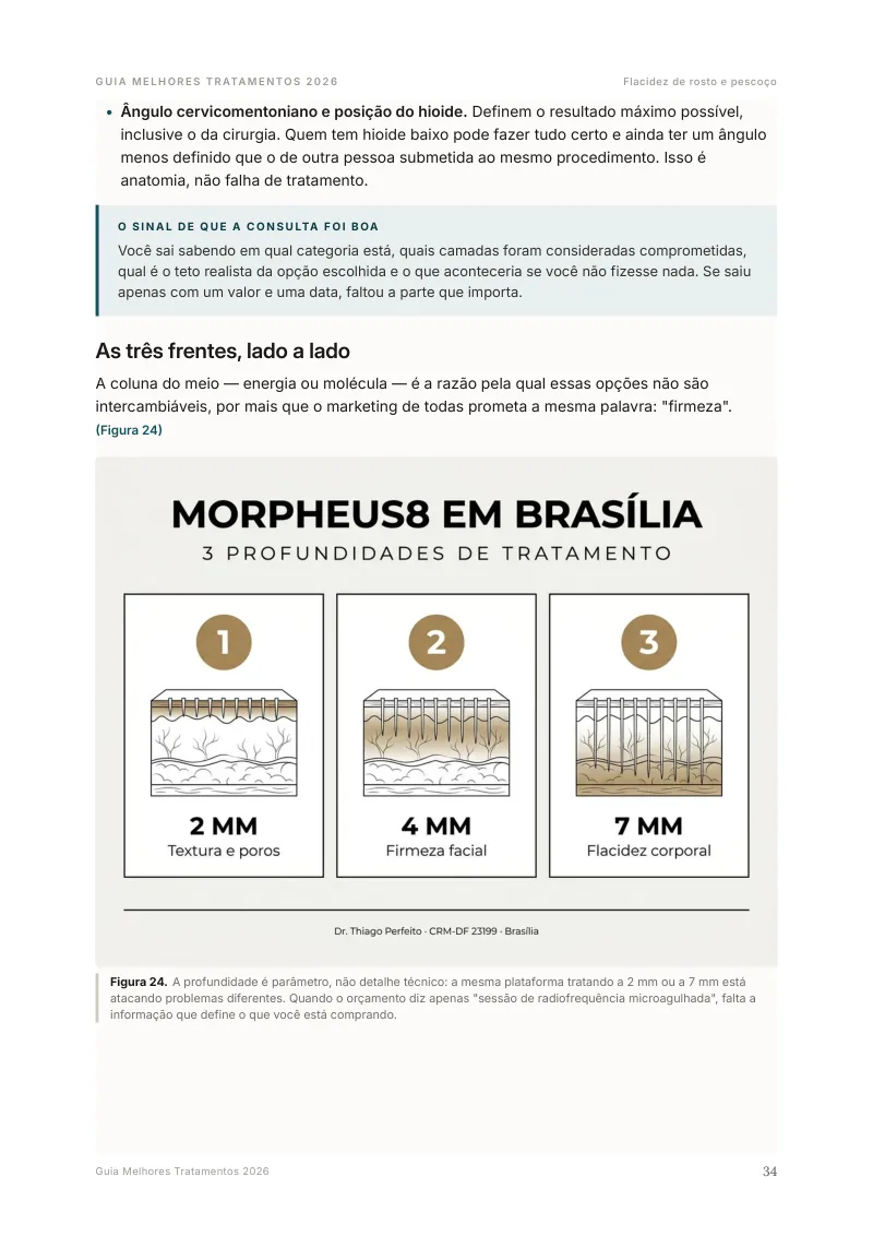 Página sobre as 3 profundidades do Morpheus8 no Guia Melhores Tratamentos 2026