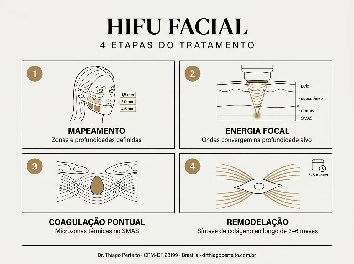 Etapas do protocolo — Oligiox