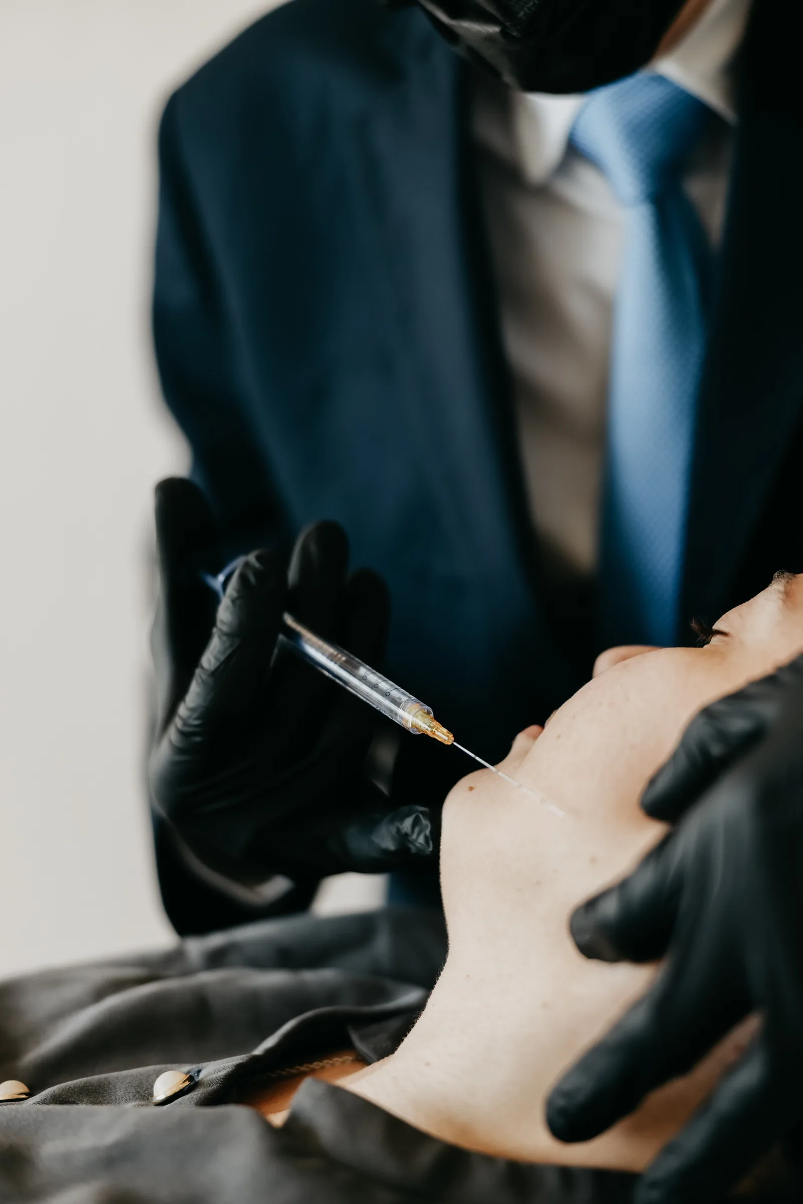 Preenchimento Labial em Brasília — Dr. Thiago Perfeito, técnica de aplicação no terço inferior