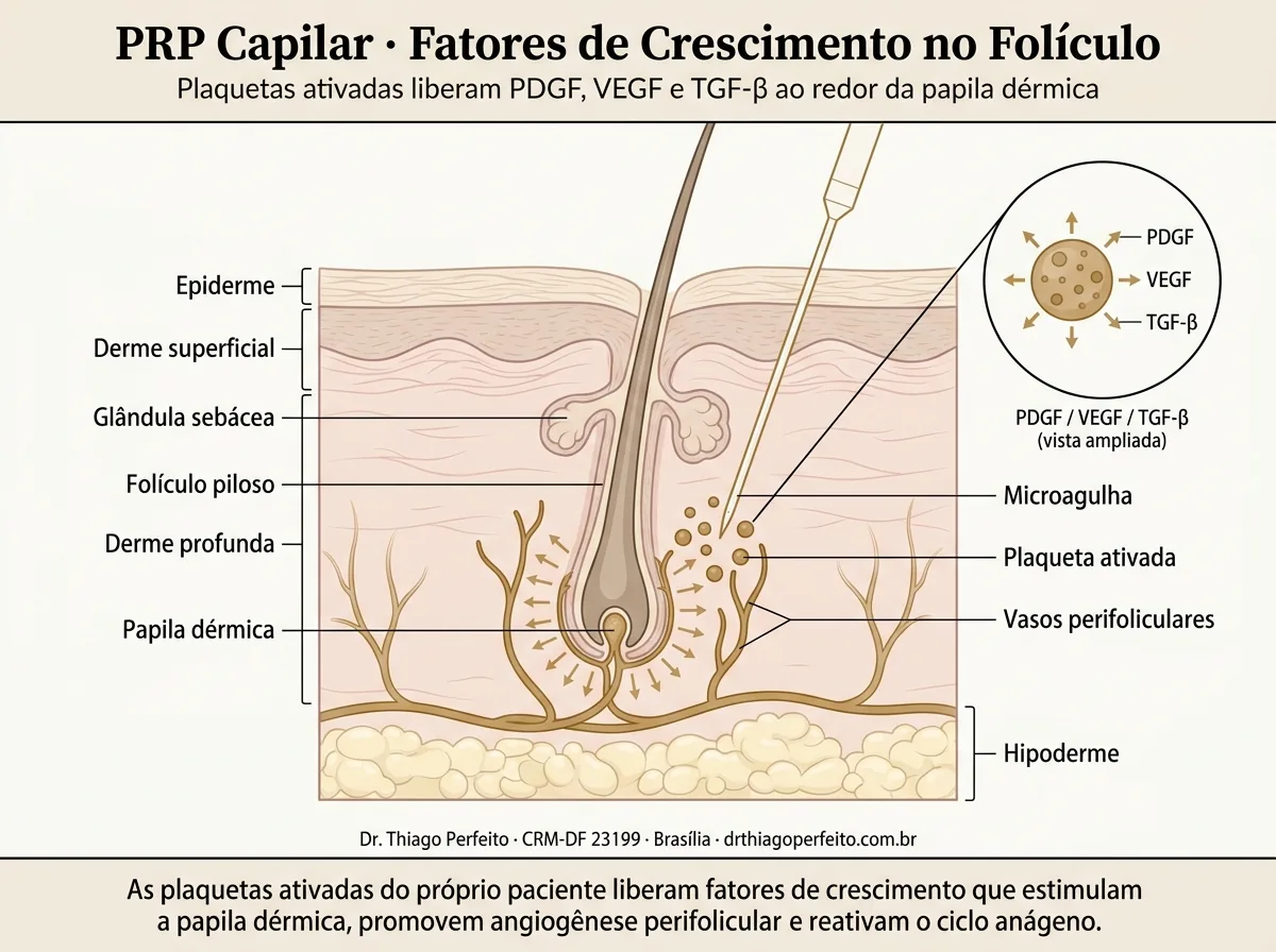 Diagrama anatômico — PRP Capilar