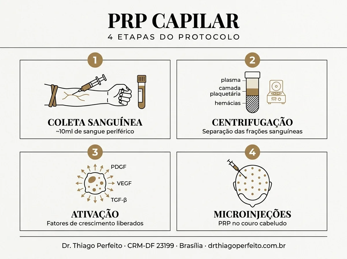 Etapas do protocolo — PRP Capilar