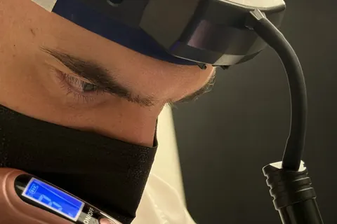 Blefaroplastia sem corte: quanto custa em Brasília?